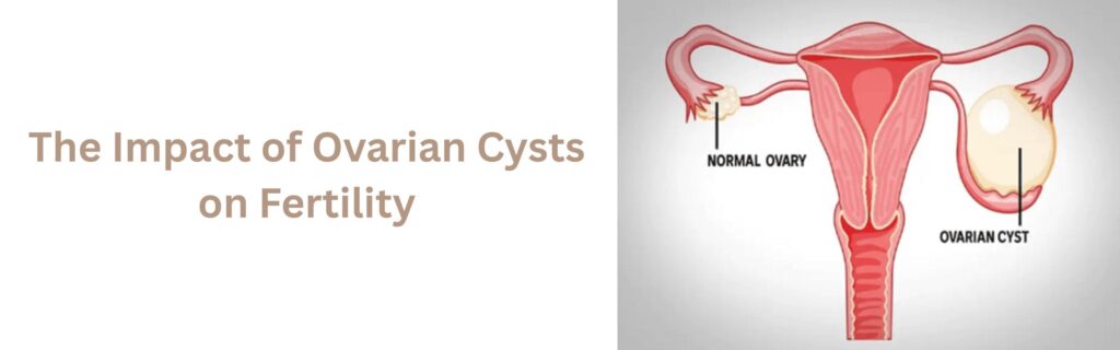 Ovarian Cysts on Fertility